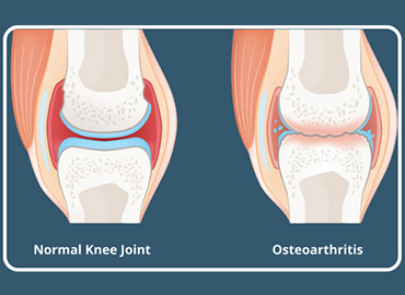 best orthopedic specialist in uppal