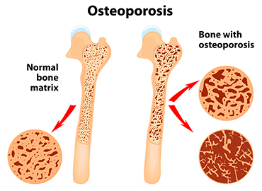 best orthopedic specialist in peerzadiguda, uppal